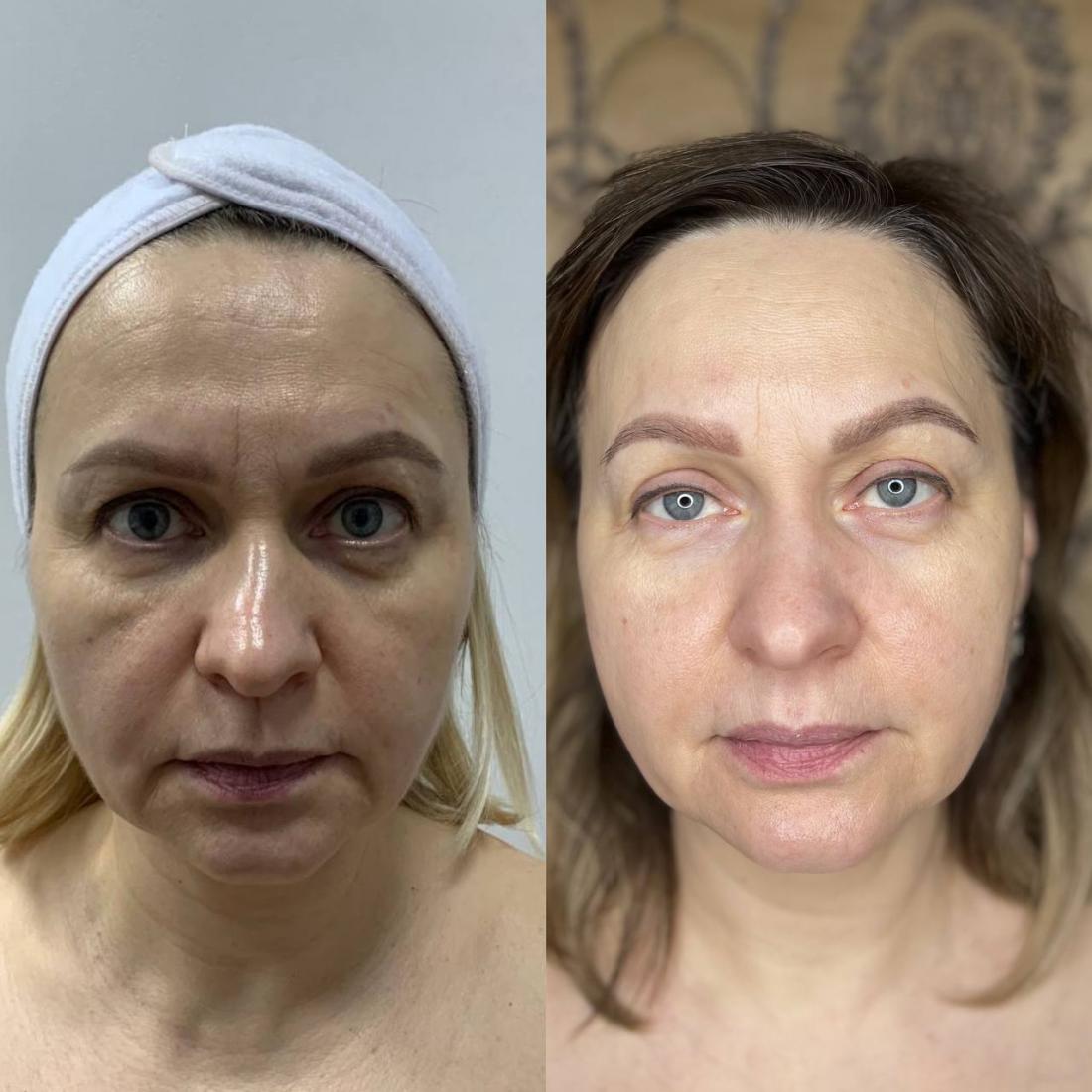 Смотрите, какая акция: лифтинг, массаж, процедуры "Anti-Age ...